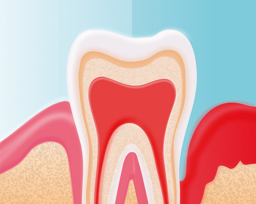 Почему болит десна под зубом?